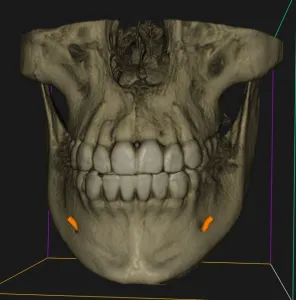 3D Imaging